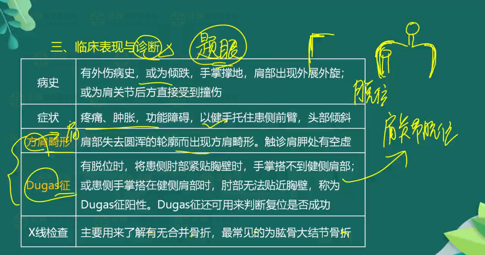 關節(jié)脫位-顳下頜關節(jié)脫位、肩關節(jié)脫位知識點總結-3